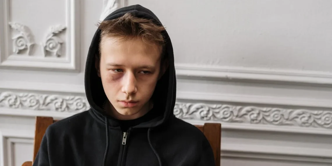 Ung mand med sorter rander under øjenene ser skræmmende ud som udtryk for sociopati