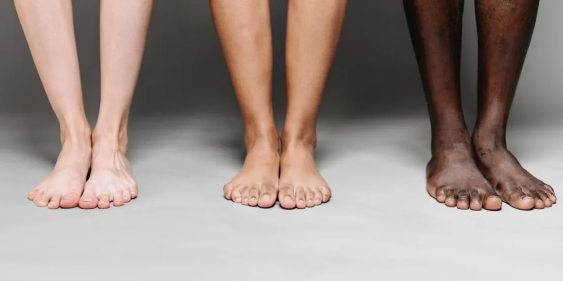 Equity Theory - her 3 sæt ben i forskellige farver som udtryk for lighedsteorien