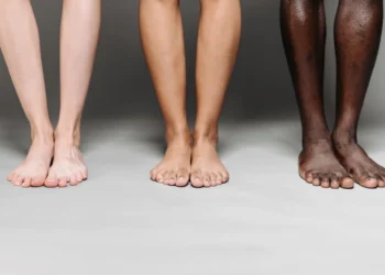 Equity Theory - her 3 sæt ben i forskellige farver som udtryk for lighedsteorien