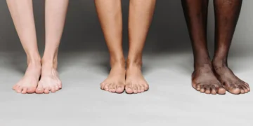 Equity Theory - her 3 sæt ben i forskellige farver som udtryk for lighedsteorien